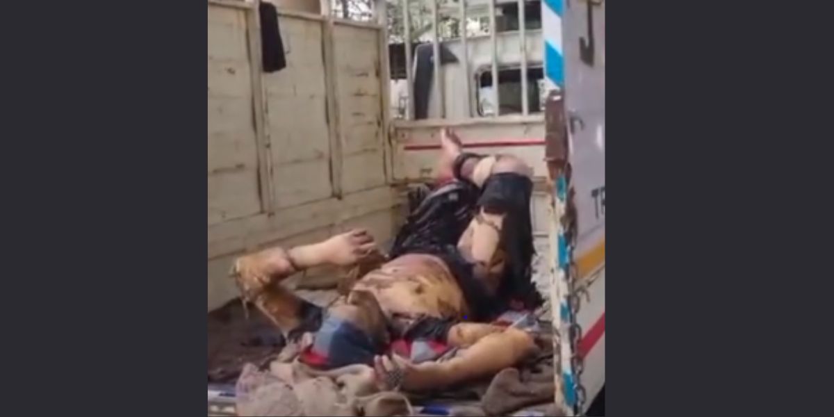 Man Sets Himself on Fire in Jalandhar After Family Dispute, Condition Critical ðŸš‘ðŸ”¥